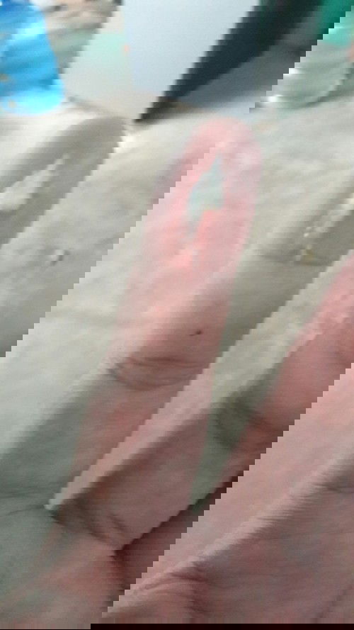 37w5d มีแบบนี้ออกมาจากอวัยยะเพศแบบนี้เรียกมูกหรือหมาดขาวค่ะท้องแรกไม่มีประสบการณ์ทางด้านนี้เลย😥😥😥