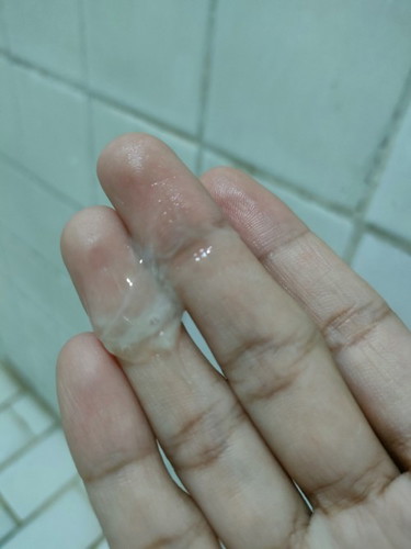 Discharge na parang sipon