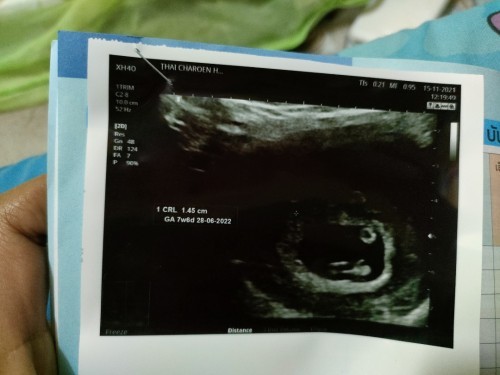 แม่ๆคิดว่าจะได้แฝดมั้ยย