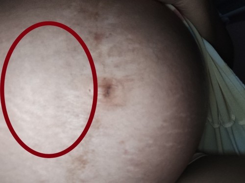 Pain in the left side
