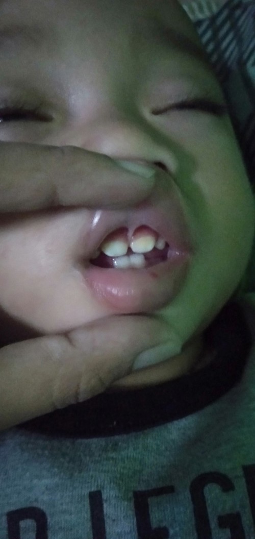 Apakah ini liptie