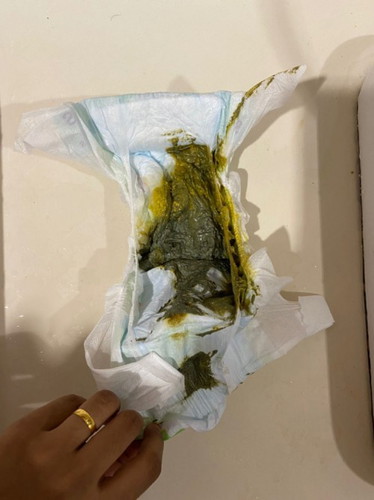 ank susu s-26.umo 3 bulan nomal ke utk bby susu formula. klo najis mcm nie