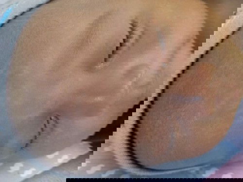 Hai mom,mau minta saran nih di sekitar wajah dan leher derek bayi ada bercak" putih itu apa ya