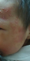 ลูกมีคราบสีขาวข้างหู ดูแลยังไงคะ น้องคลอดได้ 25 วันค่ะ