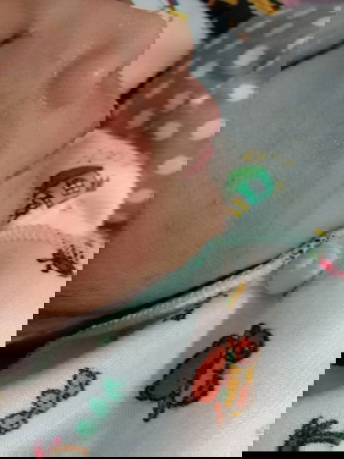 Cream muka bayi bruntusan