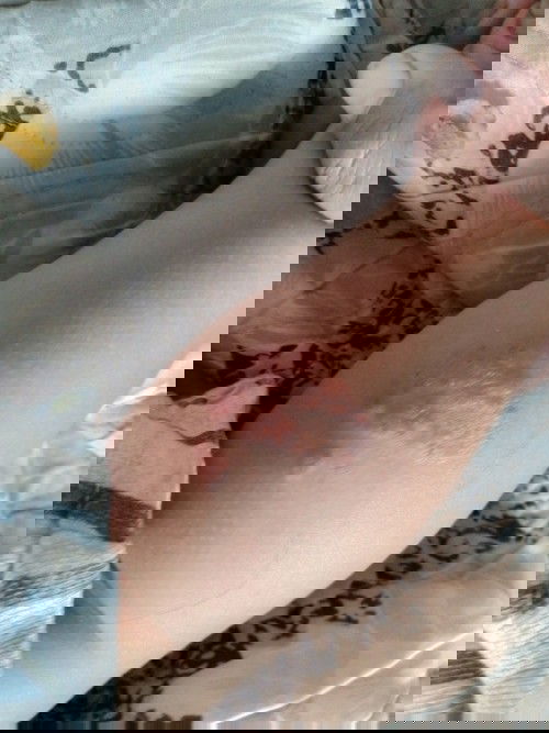 แผลที่ขายอยากทราบว่ากร่วันหาย