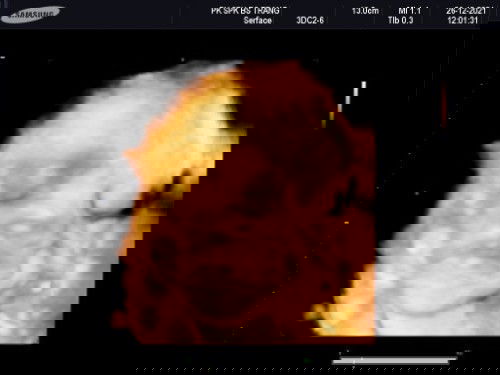 30w2d bé nhà các mom bnhiu cân ạ