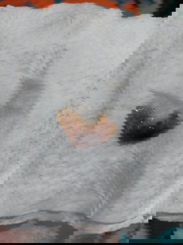 Discharges