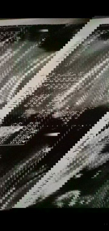 Bingung Yang Benar Hasil Usg Atau Bidan