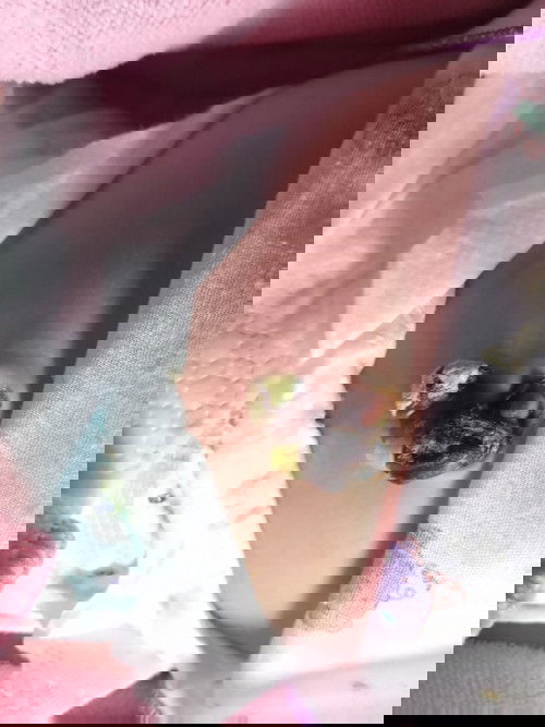 สะดือแบบนี้ใกล้หลุดยังค่ะแม่ๆ