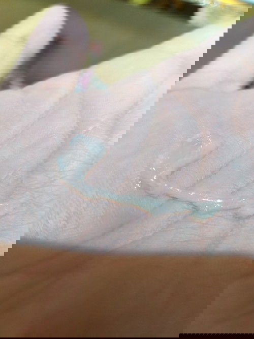 Mucus plug po ba ito?