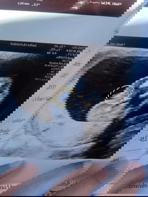 Baby girl or baby boy?