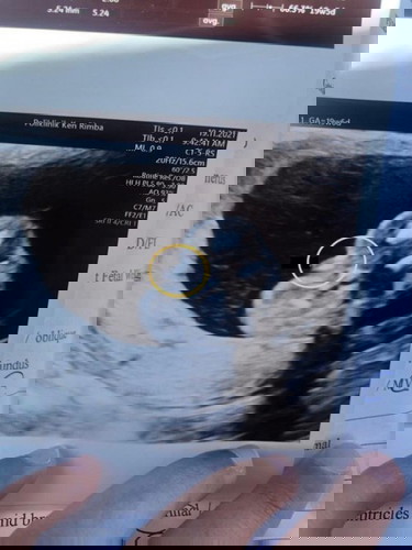 Baby girl or baby boy?