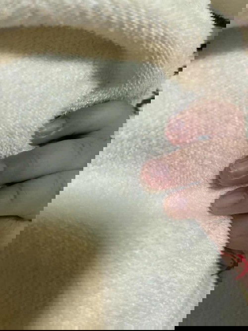 ลูก2เดือน เล็บแบบนี้คืออะไรคะ