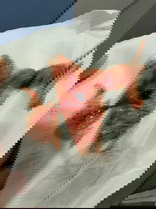 Hamil 7 minggu lebih. normal tak jika ada keluar darah mcm dlm gambar..?