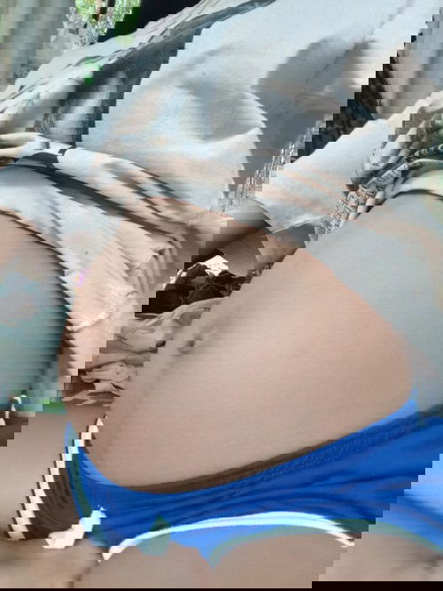 #ใครมีประสบการณ์ท้องแตกแล้วใช้อะไรทาไม่ให้แตกคะ