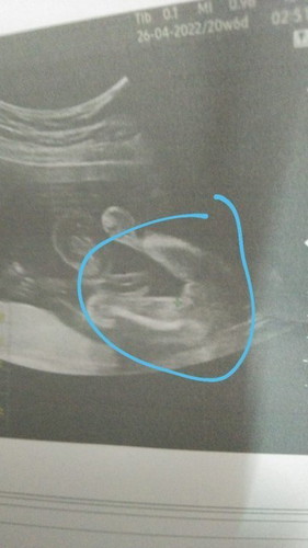 Girl or boy?