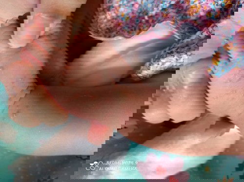 Bayi new born gatal gatal