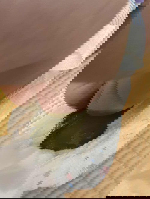 Normal ke poop baby minum susu fm macam ni ?