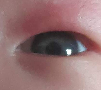 eye color (Filipino)
