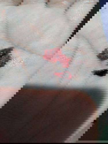 อันตรายไหมค่ะ แนะนำหน่อยค่ะ