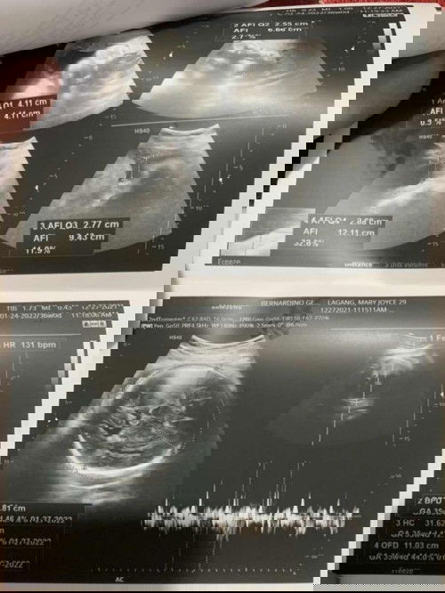 Mga momsh my tanong lan ako. 😅