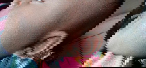 Muka sama perut kasar