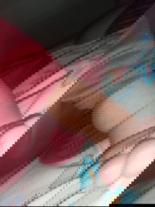 Bintik Merah (biang kringet)