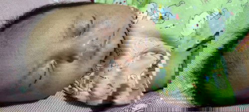 Obat utk bintik2 merah