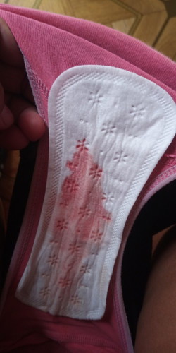 implantation bleeding