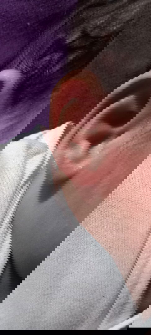 Gamot sa sugat sa likod ng tenga ni baby.