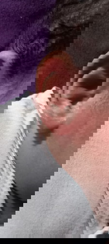 Gamot sa sugat sa likod ng tenga ni baby.