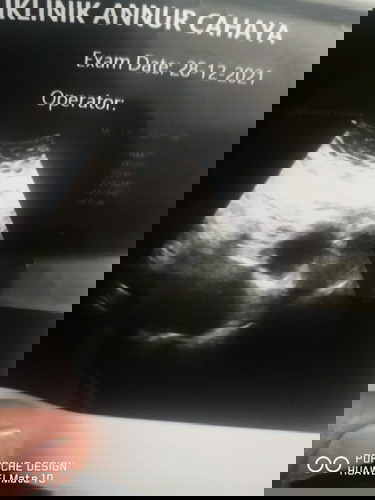 7 minggu tp Doc ckp kosong