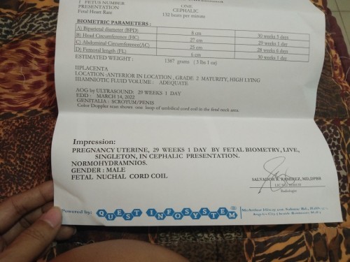 Pwede ba mag napkin ang buntis?