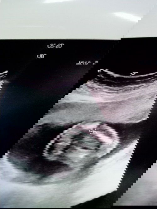 แม่ๆพอมองกันออกไหมว่าญ/ช
อายุครรภ์​19+4​ แม่บ้านนี้มองไม่ออกจริงๆ