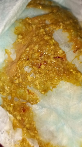 My baby's poop