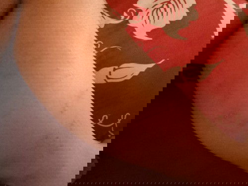 gatal gatal saat hamil