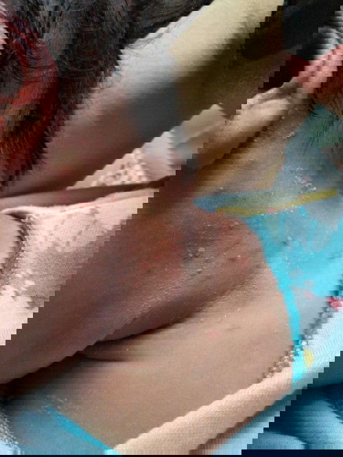 Kulit bayi 6hari seperti ini kenapa dan bagaimana ya