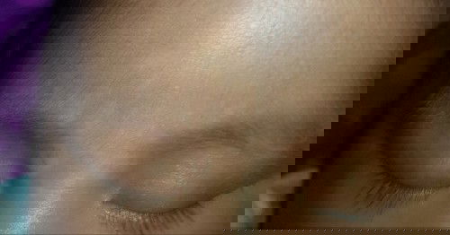 Belang/bercak putih.