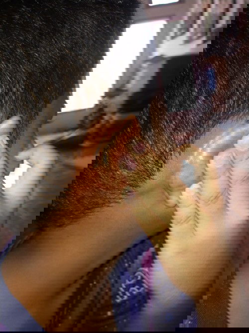 Benjolan di belakang telinga