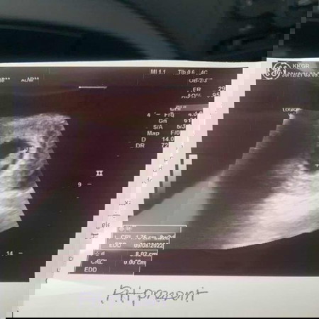 Scan baby 👶