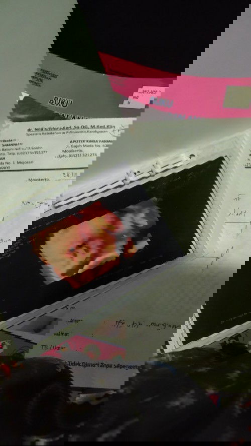 Bingung mau lahiran normal atau operasi