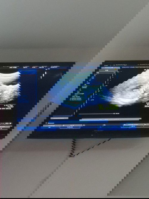 ท้องแรกค่ะ