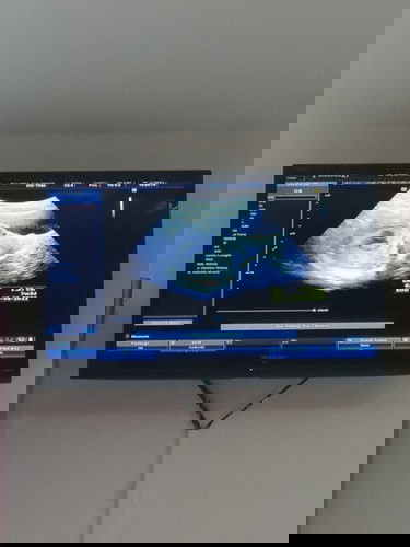 ท้องแรกค่ะ