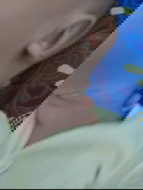 Biang keringat dan ruam popok