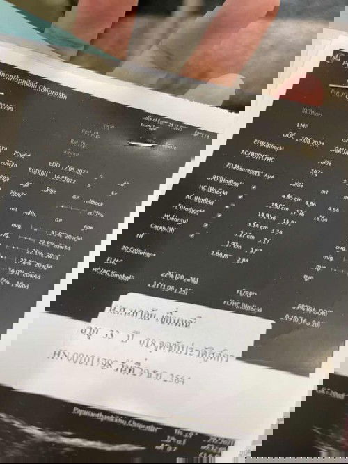 ทีมพฤษภาคม65 20 วีค6 วัน 
หนัก347 แม่ๆทีมเดียวกัน น้องหนักเท่าไหร่แล้วคะ