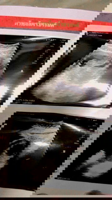 ดีใจที่มีเค้า