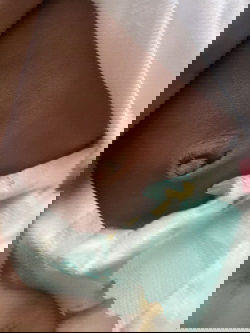 mga mamsh pa help po nalaglag n ung pusod ng baby ko pero may ganto po sa pusod nya ano po ito at anong dapat gawin?