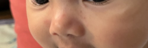 salam ,sy nk tanya ,bayi sy umur 6bulan 23hari,merah2 di atas hidung itu kenapa ye?sy jadi runsing,ada siapa2 tahu?