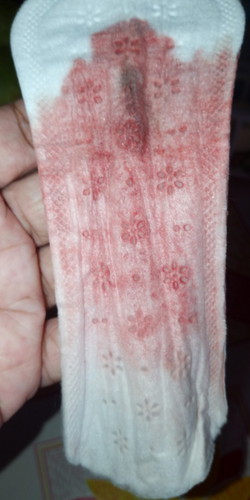 implantaion bleeding